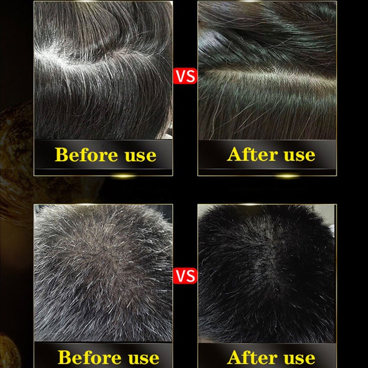 BLOSDREAM Black Hair Shampoo 3 in 1-100ml