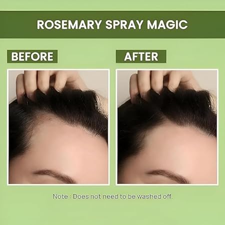 Rosemary Water, Hair Spray For Regrowth (Pack of 3 Bottle & 1 Sprayer)