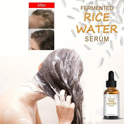Organic Fermented Rice Water Hair Growth Serum (Options: Pack of 1 Or 2)