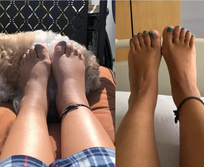 NEURO-EASE COMPRESSION SOCKS – TOTAL RELIEF FOR TIRED, SWOLLEN FEET