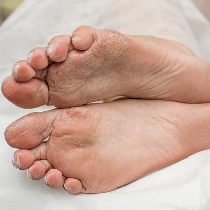 NEURO-EASE COMPRESSION SOCKS – TOTAL RELIEF FOR TIRED, SWOLLEN FEET