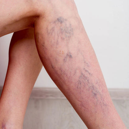NEURO-EASE COMPRESSION SOCKS – TOTAL RELIEF FOR TIRED, SWOLLEN FEET